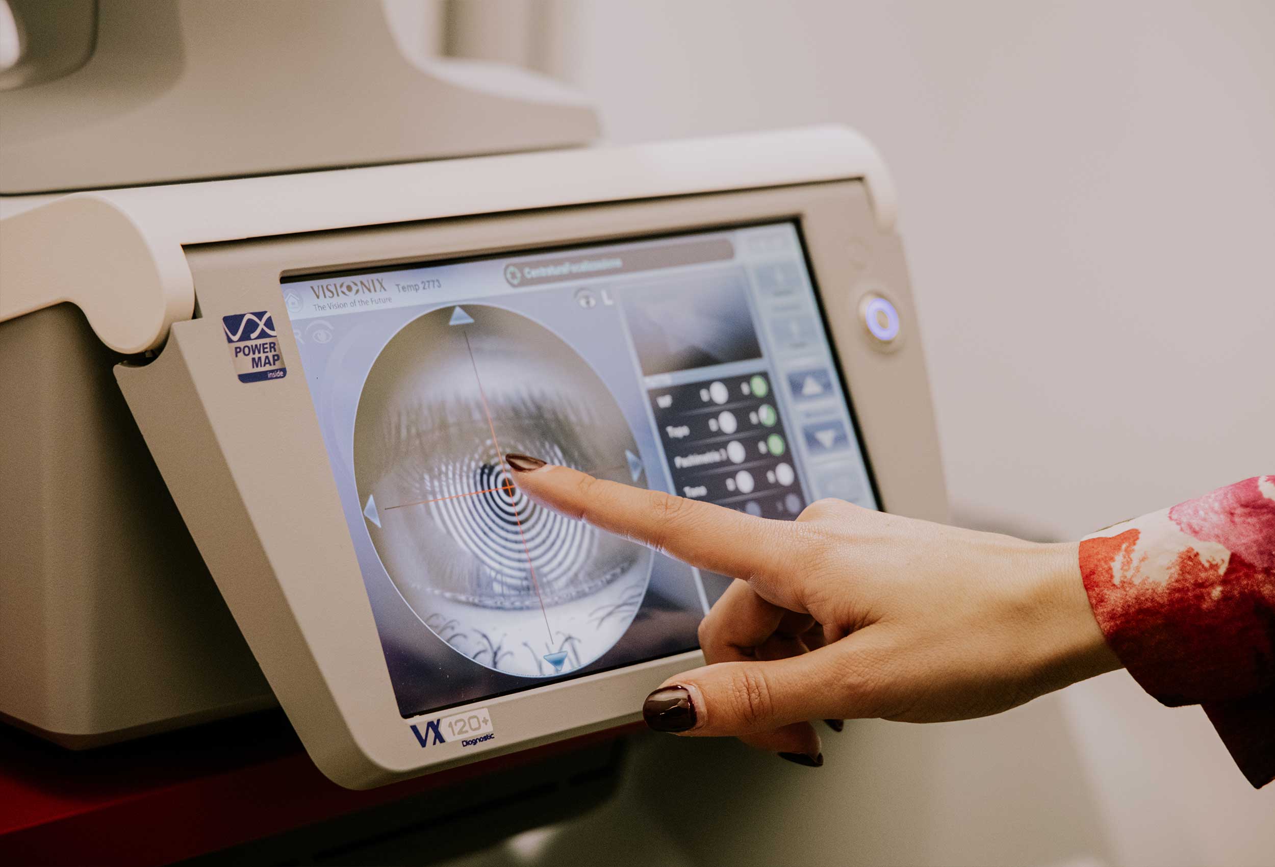 Screenin Ortottico Ottica sipario alba Francesca